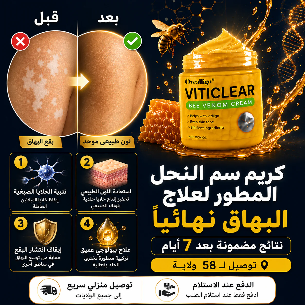 كريم علاج البهاق VITICLEAR
